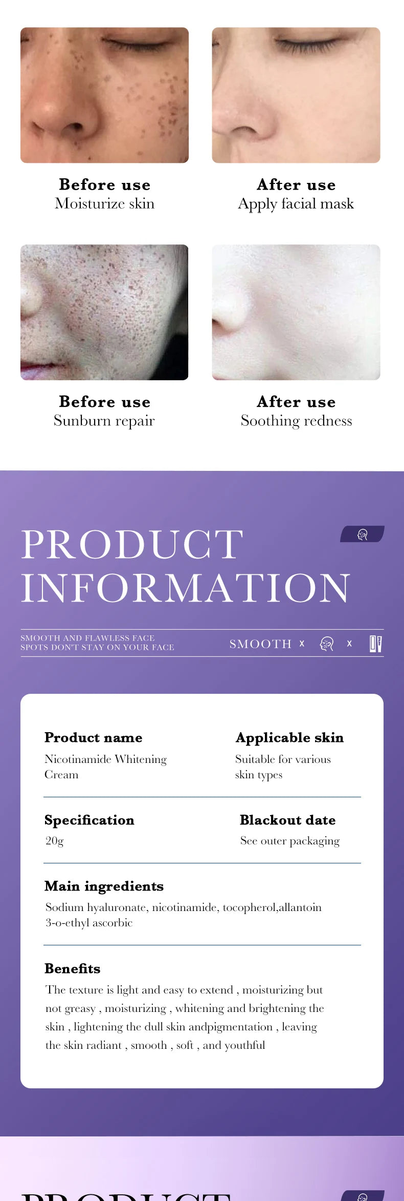 Niacinamide evens skin tone, whitens and removes freckle cream, deeply nourishes, moisturizes, hydrates and brightens the cream