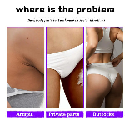 Inner Thigh Whitening Cream Private Parts Underarm Bleaching Cream Whiten Butt Knee Brighten Melanin Intimate Dark Skin Care 60g