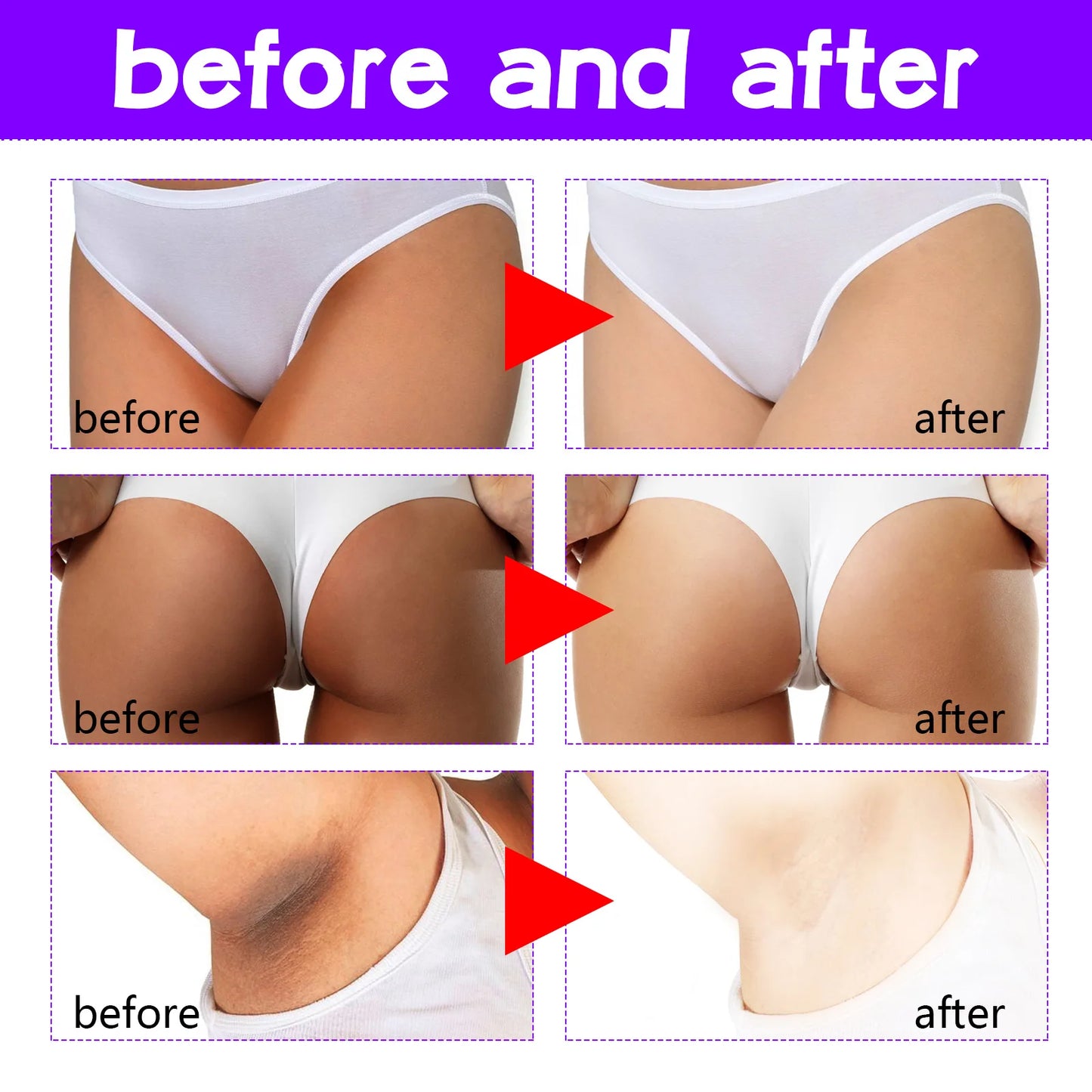 Inner Thigh Whitening Cream Private Parts Underarm Bleaching Cream Whiten Butt Knee Brighten Melanin Intimate Dark Skin Care 60g