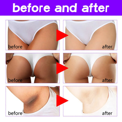 Inner Thigh Whitening Cream Private Parts Underarm Bleaching Cream Whiten Butt Knee Brighten Melanin Intimate Dark Skin Care 60g